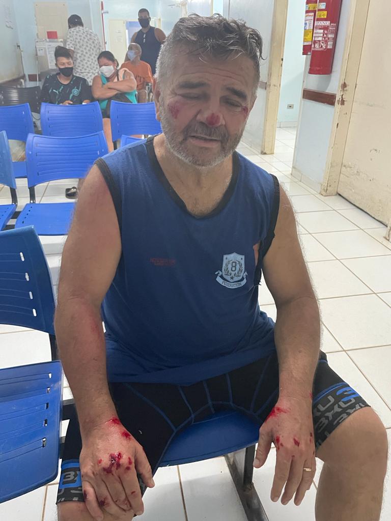 Grave queda quase tirou Mauro da competição