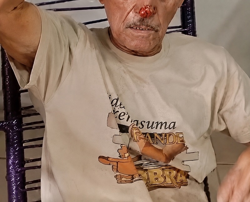 Comerciante chegou a ter o nariz mordido